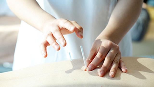 首都医校ならではの多様な治療法を修得できる！